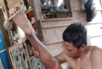 Warga Marok Kecil Selamat Usai diterkam buaya | Foto : Zonamu/Ist